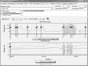 Screenshot of CP survey graphing software (Courtesy of M.C. Miller Co.)